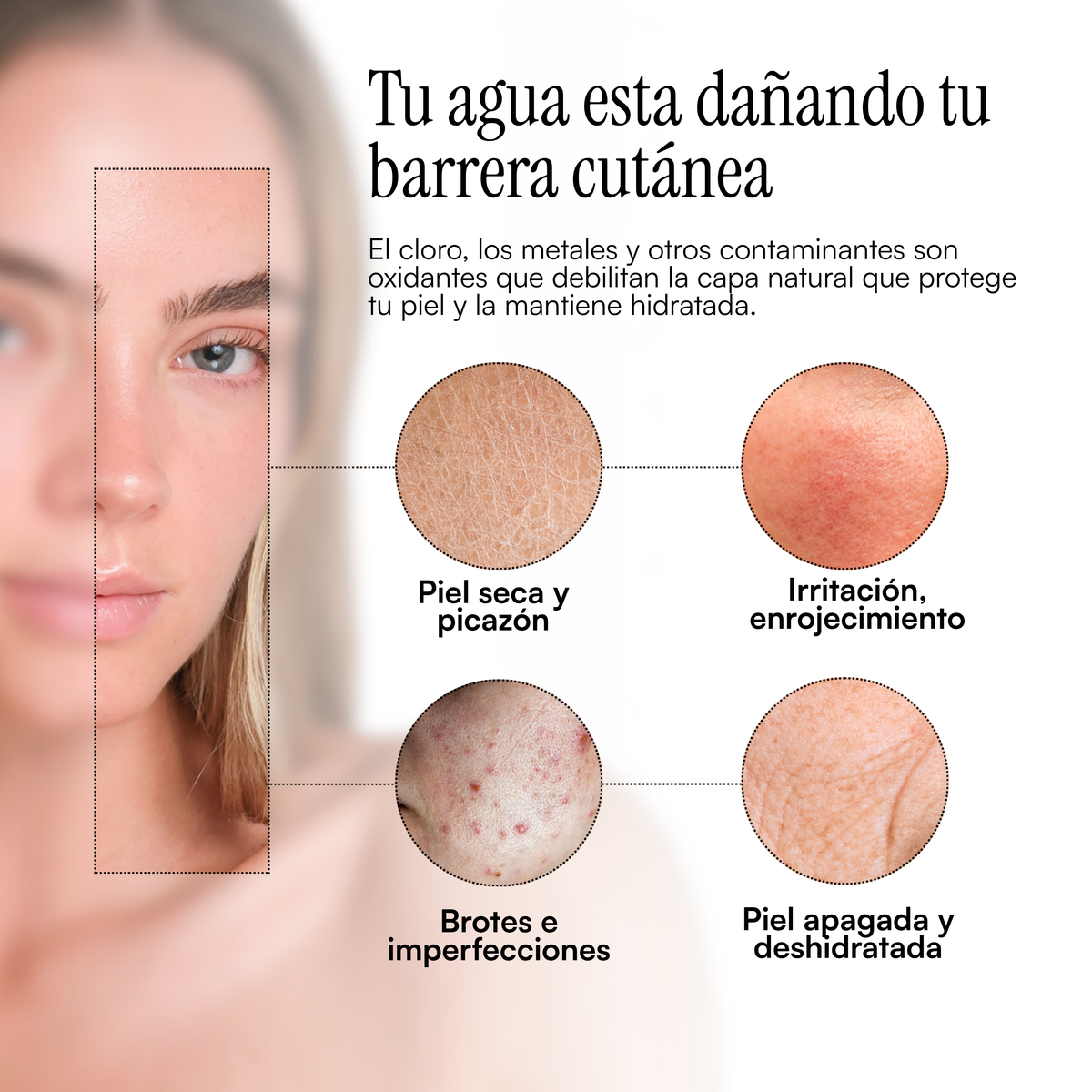 Filtro de regadera para piel y cabello