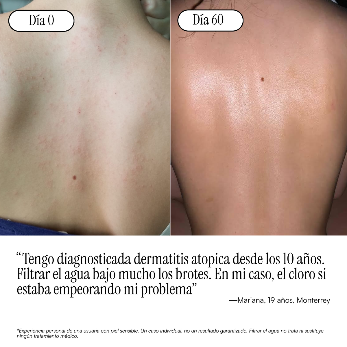 Filtro de regadera para piel y cabello